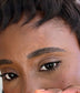 LVH contact lenses