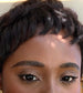 LVH contact lenses